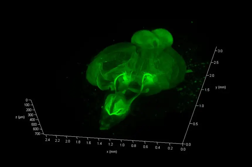 Nhìn cơn co giật chạy xuyên qua não theo 3D: Điều gì xảy ra trước khi cả mạng neuron mất kiểm soát?